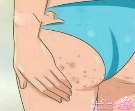 مراقبت از پوست